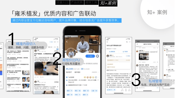 知+广告推广案例分享,一看就懂!