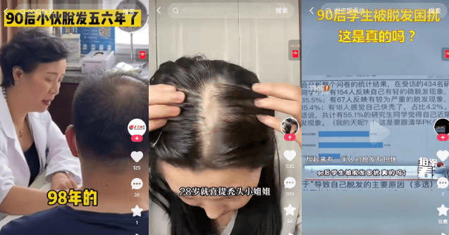 快手广告x修正|用苗坚防脱洗发水拯救老铁们的发际线!