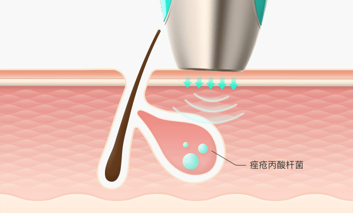 美拍广告公司meitukey皮肤检测仪正式开售填补家用市场空白