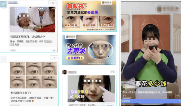 腾讯消费医疗赛道—医美行业拓客秘籍 | 微信朋友圈广告